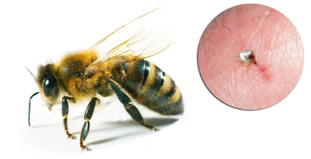 Hondrostrong enthält Bienengift, das die Stoffwechselprozesse im Gewebe verbessert. 